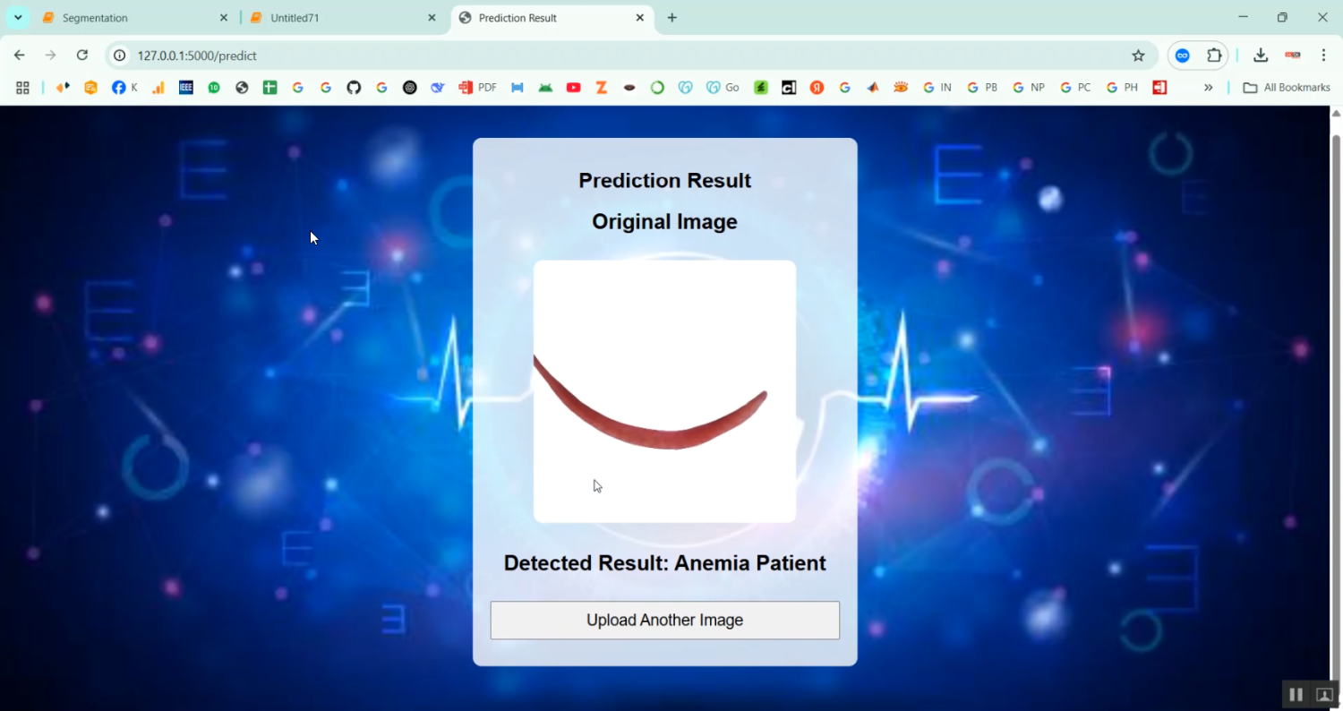 Anemia Eye Disease Detection in Python Projects