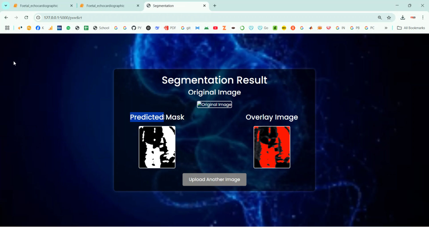 Foetal Segmentation using Image in Python Projects