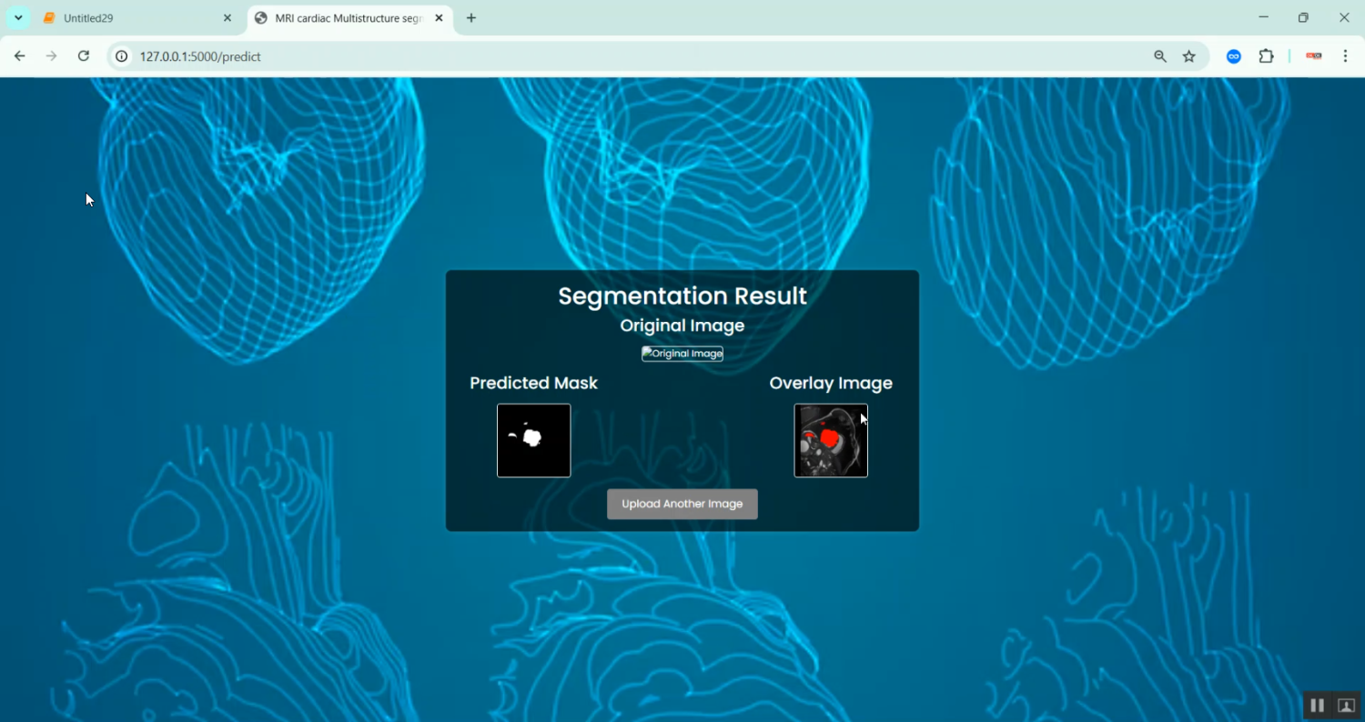 Cardiac Multi structure Segmentation using MRI Image in Python Projects