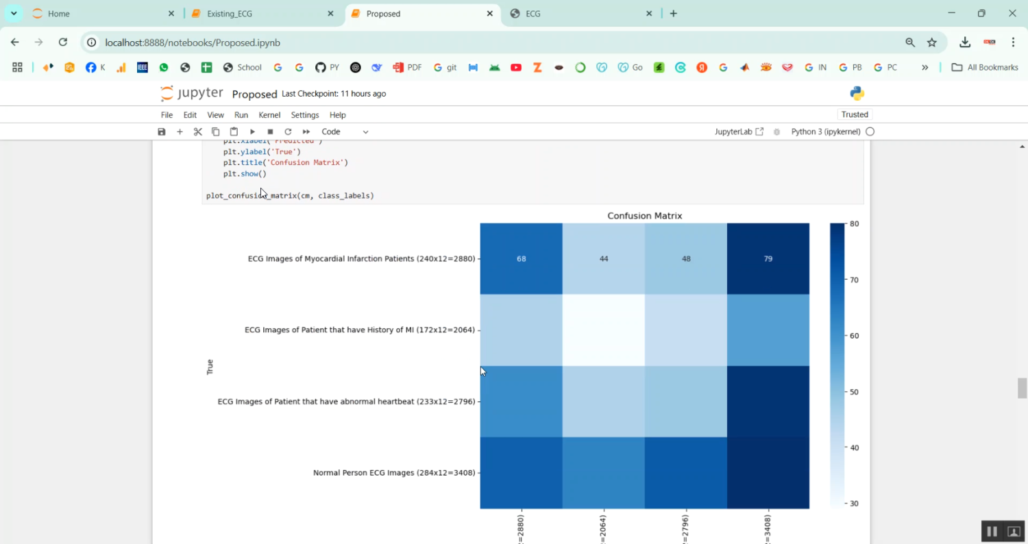 Cardiovascular Diseases in ECG Images in Python Projects
