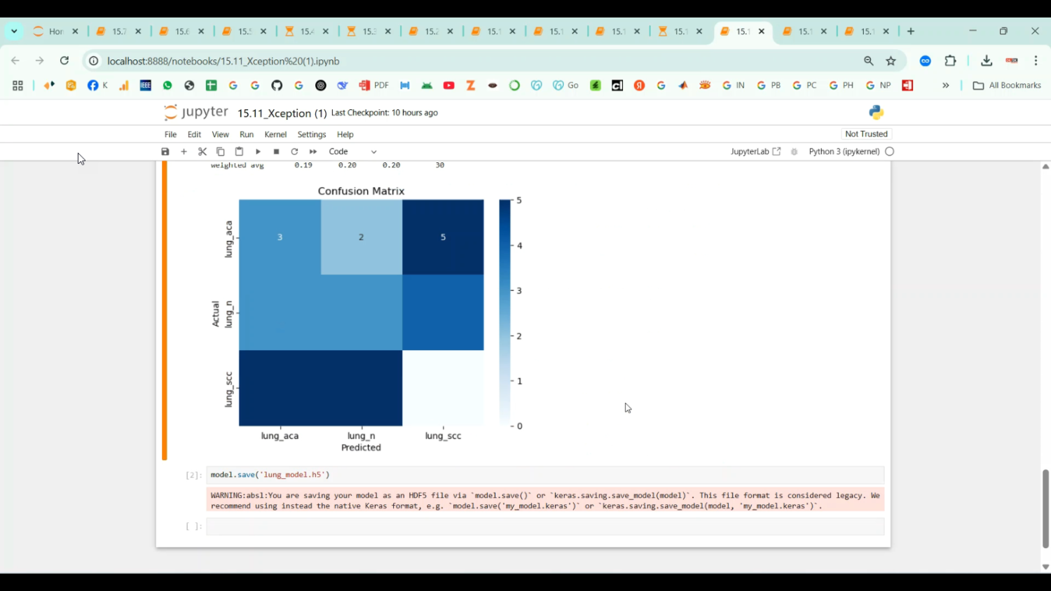 Diabetic Retinopathy Resnet50 Resnet101 VGG19 InceptionV3 Xception NASNetLarge VGG16 MobileNet DenseNet-201 in Python Projects
