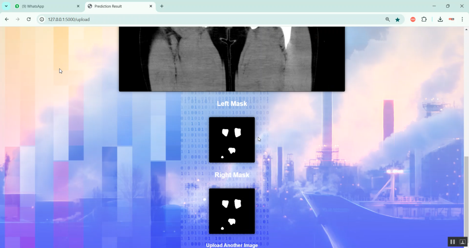 Kidney Tumor Segmentation in Python Projects