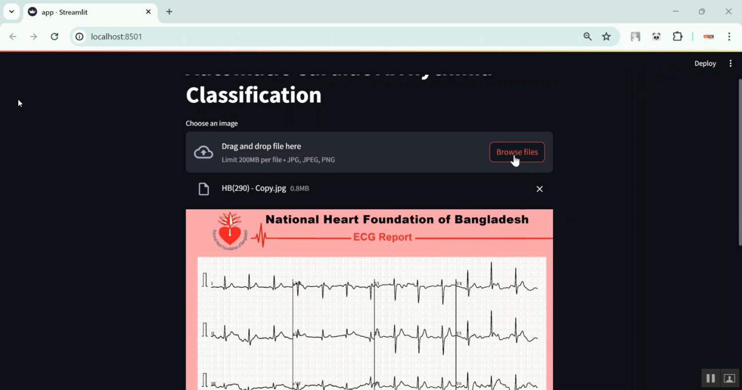 Cardiac Arrhythmia Classification in Python Projects